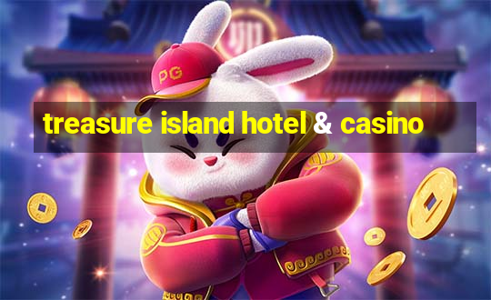 treasure island hotel & casino